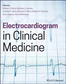 Electrocardiogram in Clinical Medicine