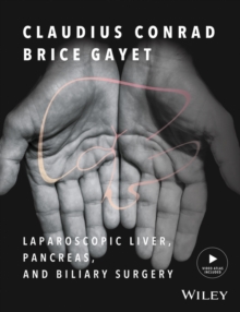 Laparoscopic Liver, Pancreas, and Biliary Surgery