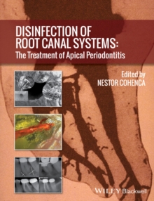 Disinfection of Root Canal Systems : The Treatment of Apical Periodontitis