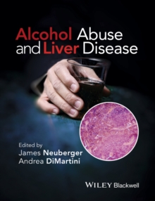 Alcohol Abuse and Liver Disease