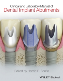 Clinical and Laboratory Manual of Dental Implant Abutments