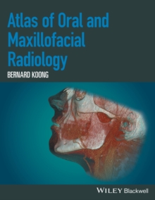 Atlas of Oral and Maxillofacial Radiology, Hardback Book Atlas of Oral and Maxillofacial Radiology, Hardback Book