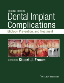 Dental Implant Complications : Etiology, Prevention, and Treatment