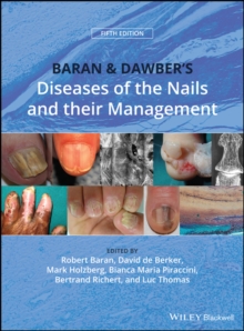 Baran and Dawber's Diseases of the Nails and their Management