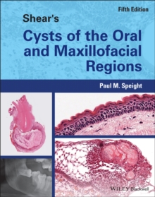 Shear's Cysts of the Oral and Maxillofacial Regions