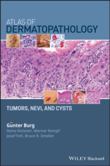 Atlas of Dermatopathology : Tumors, Nevi, and Cysts, Hardback Book Atlas of Dermatopathology : Tumors, Nevi, and Cysts, Hardback Book