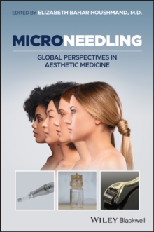 Microneedling : Global Perspectives in Aesthetic Medicine