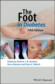 The Foot in Diabetes