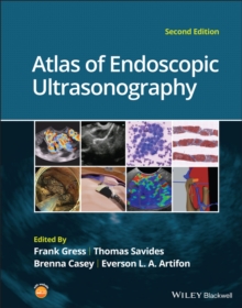 Atlas of Endoscopic Ultrasonography