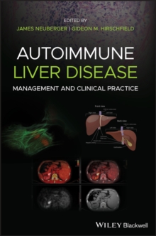 Autoimmune Liver Disease : Management and Clinical Practice