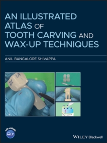 An Illustrated Atlas of Tooth Carving and Wax-Up Techniques