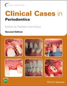 Clinical Cases in Periodontics