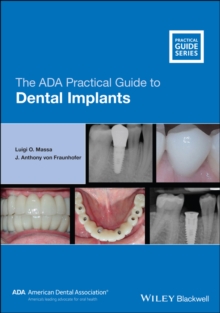 The ADA Practical Guide to Dental Implants