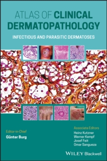 Atlas of Clinical Dermatopathology : Infectious and Parasitic Dermatoses