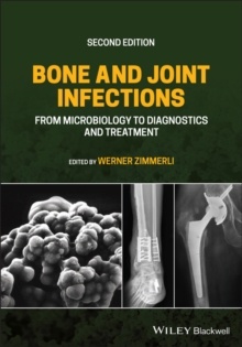 Bone and Joint Infections : From Microbiology to Diagnostics and Treatment