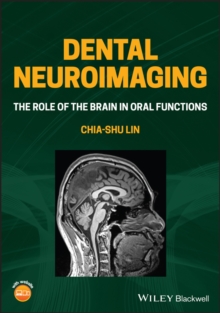 Dental Neuroimaging : The Role of the Brain in Oral Functions