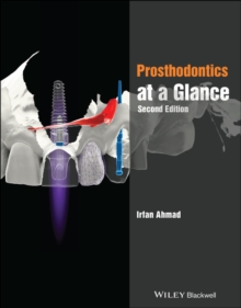 Prosthodontics at a Glance