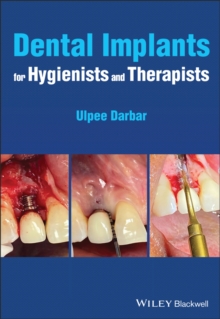 Dental Implants for Hygienists and Therapists