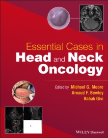 Essential Cases in Head and Neck Oncology