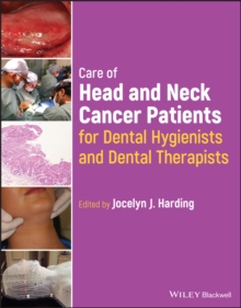 Care of Head and Neck Cancer Patients for Dental Hygienists and Dental Therapists