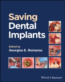 Saving Dental Implants