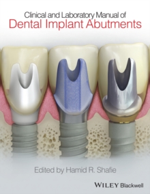 Clinical and Laboratory Manual of Dental Implant Abutments, Hardback Book Clinical and Laboratory Manual of Dental Implant Abutments, Hardback Book