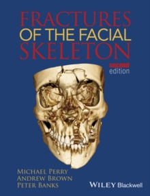 Fractures of the Facial Skeleton, Paperback / softback Book Fractures of the Facial Skeleton, Paperback / softback Book
