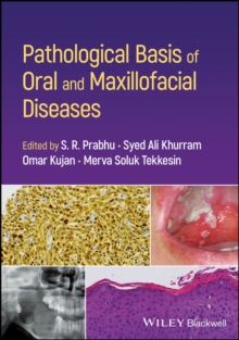 Pathological Basis Of Oral And Maxillofacial Diseases