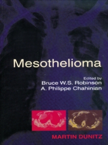 Mesothelioma