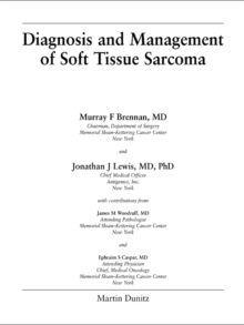 Diagnosis and Management of Soft Tissue Sarcoma