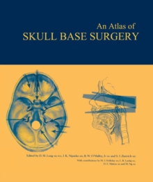 Atlas of Skull Base Surgery