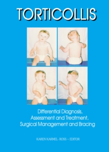 Torticollis : Differential Diagnosis, Assessment and Treatment, Surgical Management and Bracing