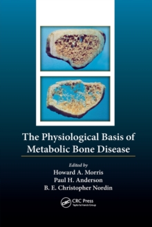 The Physiological Basis of Metabolic Bone Disease, Paperback / softback Book The Physiological Basis of Metabolic Bone Disease, Paperback / softback Book