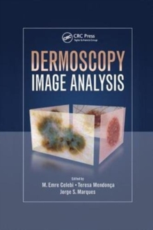 Dermoscopy Image Analysis, Paperback / softback Book Dermoscopy Image Analysis, Paperback / softback Book
