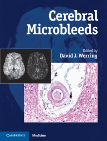 Cerebral Microbleeds : Pathophysiology to Clinical Practice