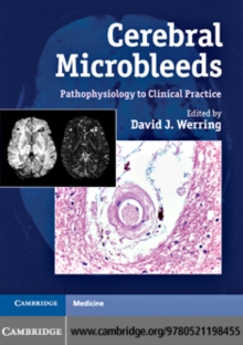 Cerebral Microbleeds : Pathophysiology to Clinical Practice