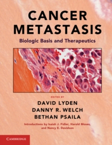 Cancer Metastasis : Biologic Basis and Therapeutics