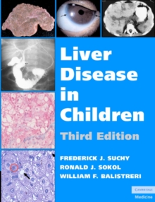 Liver Disease in Children