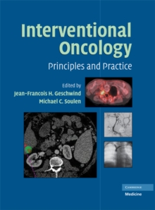 Interventional Oncology : Principles and Practice