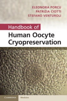 Handbook of Human Oocyte Cryopreservation