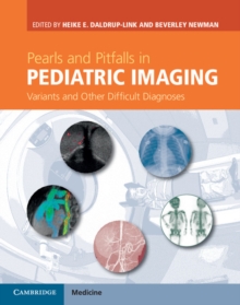 Pearls and Pitfalls in Pediatric Imaging : Variants and Other Difficult Diagnoses