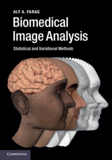 Biomedical Image Analysis : Statistical and Variational Methods