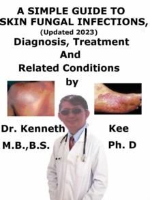 Simple Guide to Skin Fungal Infections, (Updated 2023) Diagnosis, Treatment and Related Conditions