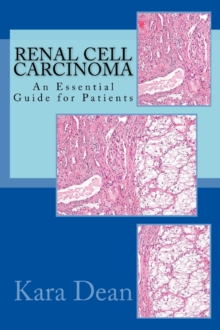 Renal Cell Carcinoma: An Essential Guide for Patients