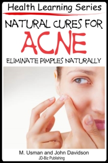 Natural Cures for Acne