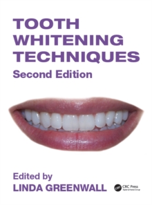 Tooth Whitening Techniques