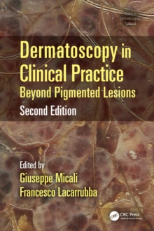 Dermatoscopy in Clinical Practice : Beyond Pigmented Lesions