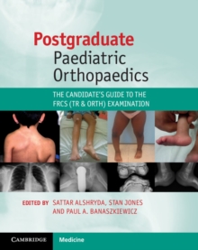 Postgraduate Paediatric Orthopaedics : The Candidate's Guide to the FRCS (Tr and Orth) Examination