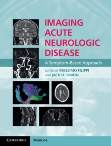 Imaging Acute Neurologic Disease : A Symptom-Based Approach