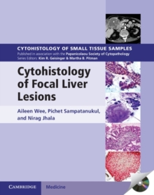 Cytohistology of Focal Liver Lesions